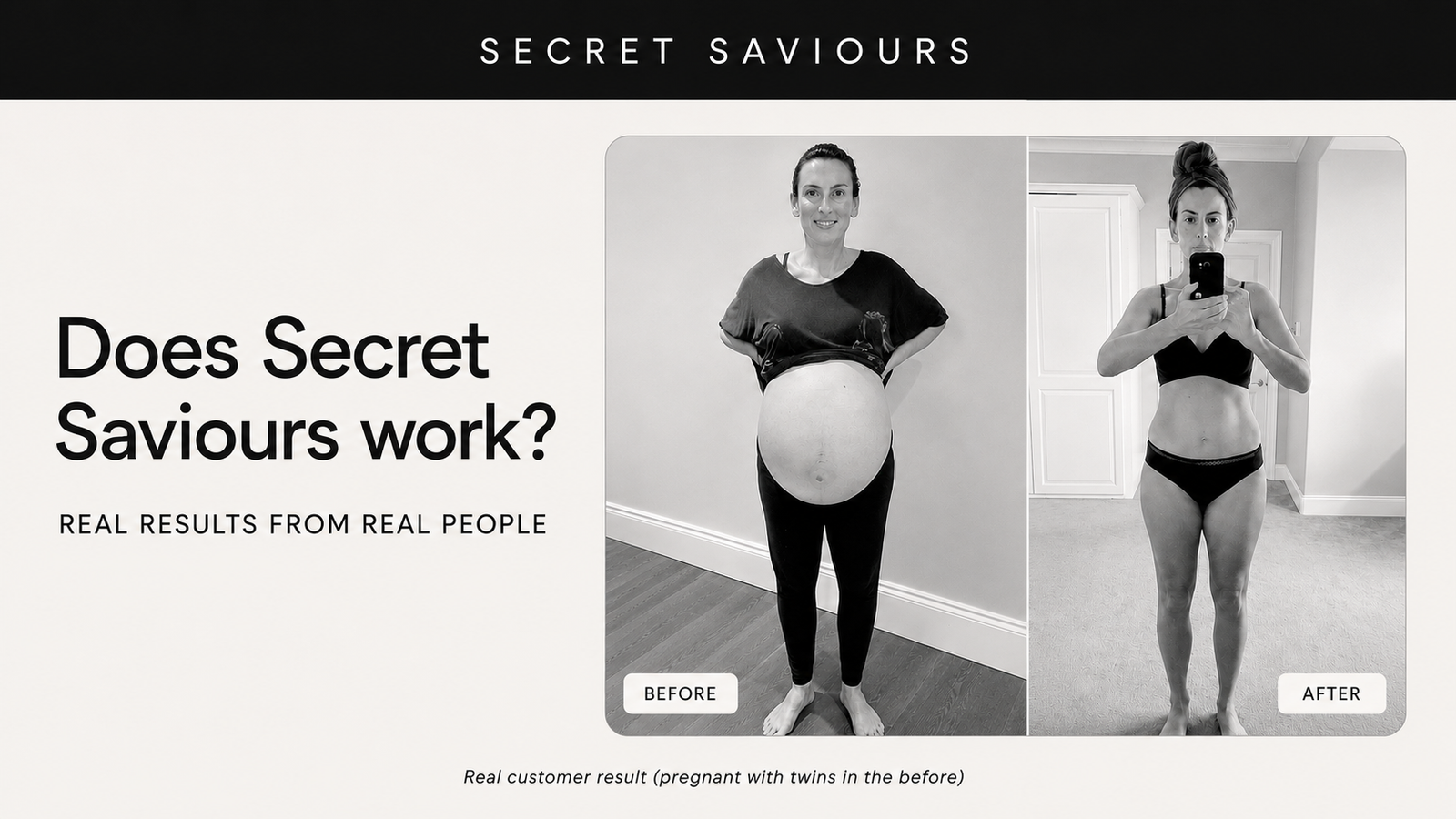 SECRET SAVIOURS STRETCH MARK PREVENTION BELLY BAND SKINCARE